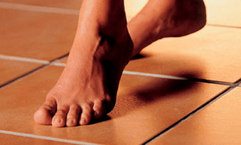 Camminare a piedi nudi come causa della comparsa del fungo sulla pelle dei piedi