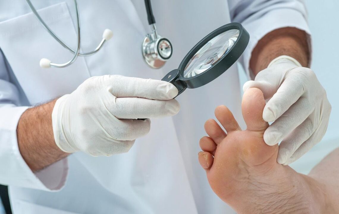 il medico esamina i piedi con il fungo